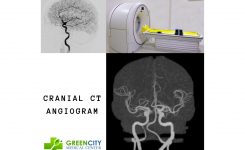 GMC Now Offers Cranial CT Angiogram