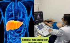 GreenCity Medical Center Offers the latest and most advanced MRI and Shear Wave Elastography in Central Luzon